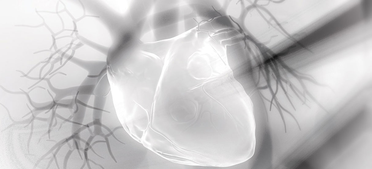 X-ray of healthy heart