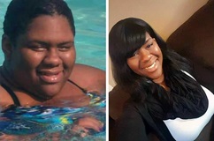 Side-by-side comparison of young woman before and after weight-loss surgery