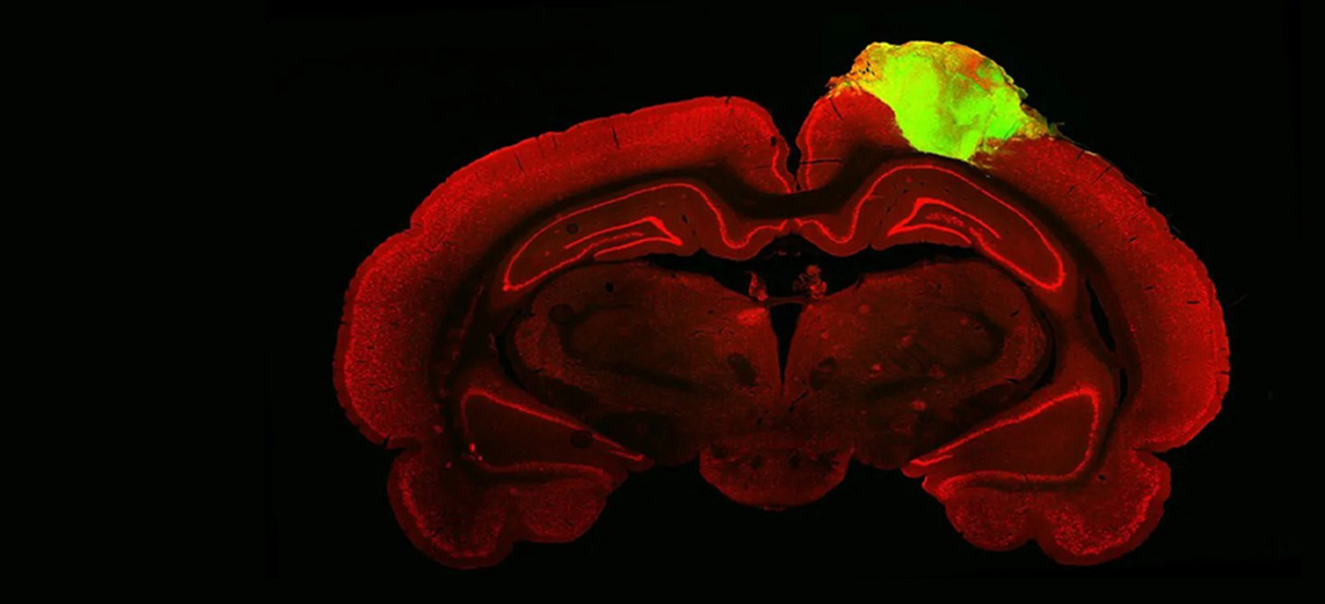 Image of rodent brain with added brain organoid