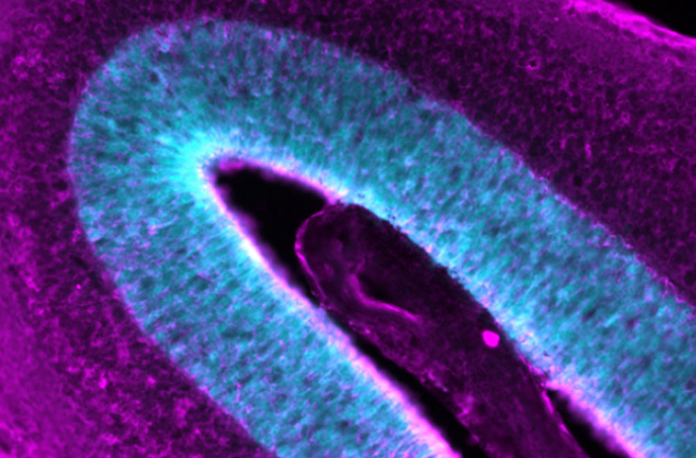 Mouse retina under microscope