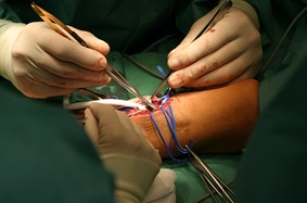hand reconstruction surgery