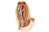 animated esophogastric junction