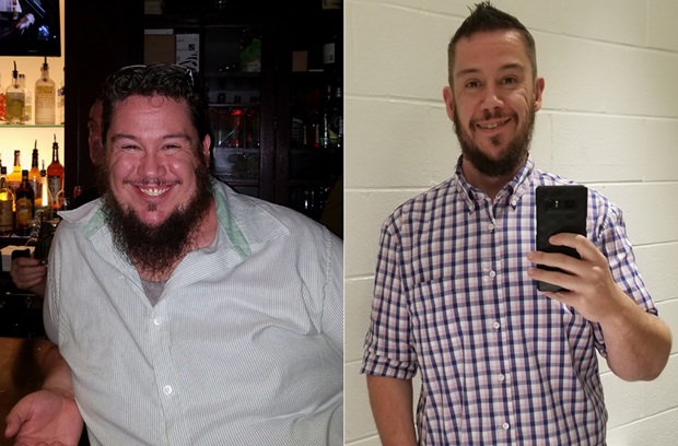 Shawn W shown before and after weight-loss surgery