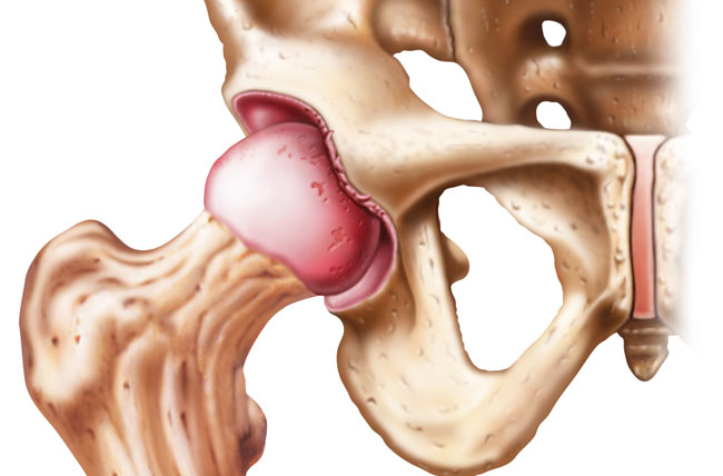 https://www.pennmedicine.org/-/media/images/medical%20and%20research%20images/anatomy/labral_tear_1.ashx