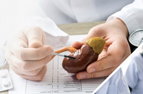 A physician holds a model of the human kidney