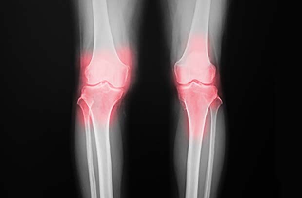 scan of knees