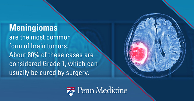 a patient with malignant pleural mesothelioma