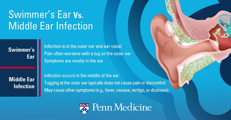 Swimmer S Ear 10 Things You Need To Know Penn Medicine