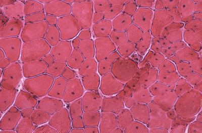Stained Muscle Cell Modeling Duchenne Muscular Dystrophy Used For The Study